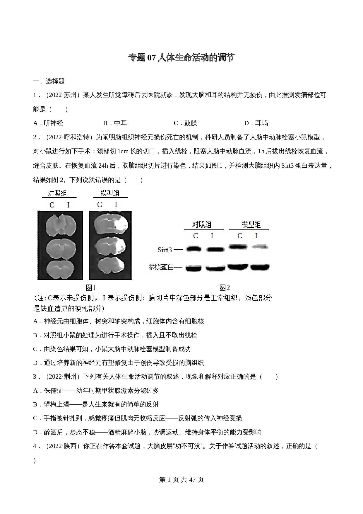 （2020-2022）中考生物真题分项汇编 专题07 人体生命活动的调节（含解析）（全国通用） 第1页